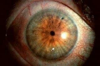 איך מזהים מנת יתר? איך מזהים מנת יתר?